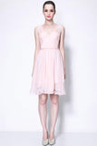 Pearl Pink A-line Homecoming Party Sweet 16 Prom Short Dress